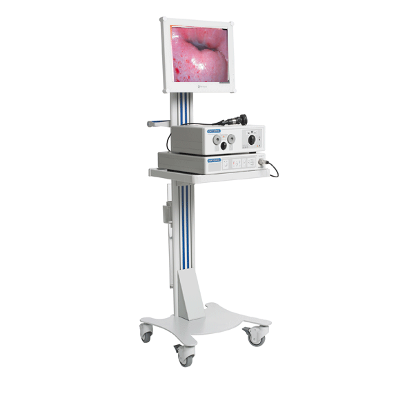 Torres de endoscopia